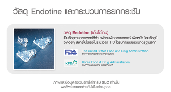 ยกคิ้ว Endotine