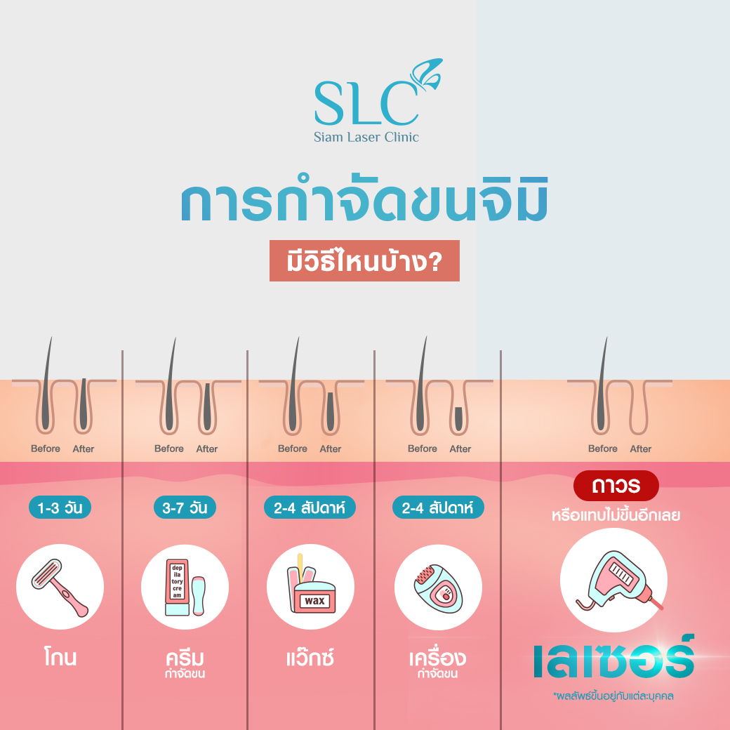 เลเซอร์ขนจิมิ