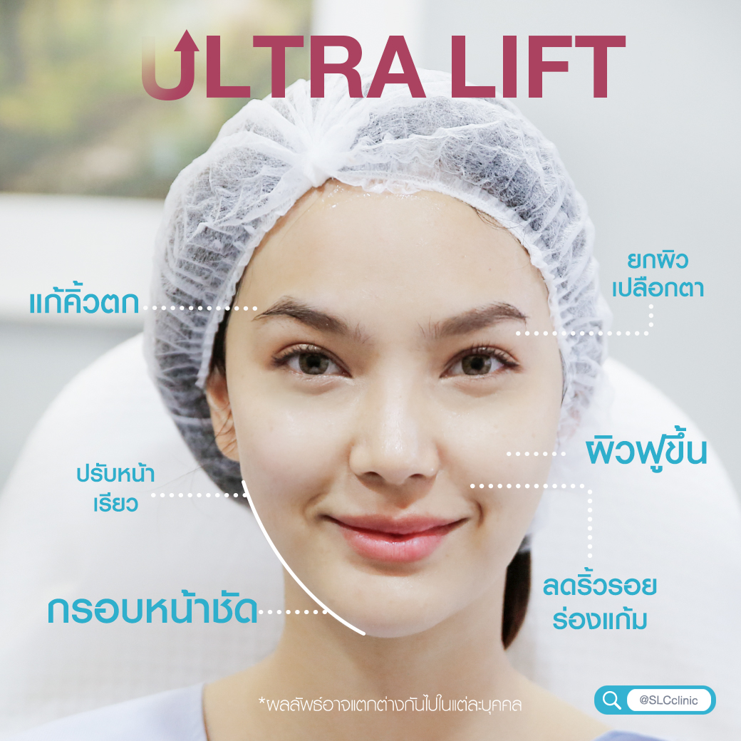 ยกกระชับ