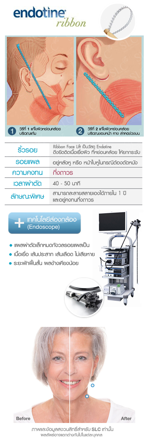 เม้าส์ นิกกี้ เสาวลักษณ์ จันทพันธ์  Suegery ศัลยกรรม  ผ่าตัดส่องหล้อง ยกคิ้ว ยกหน้าผาก 