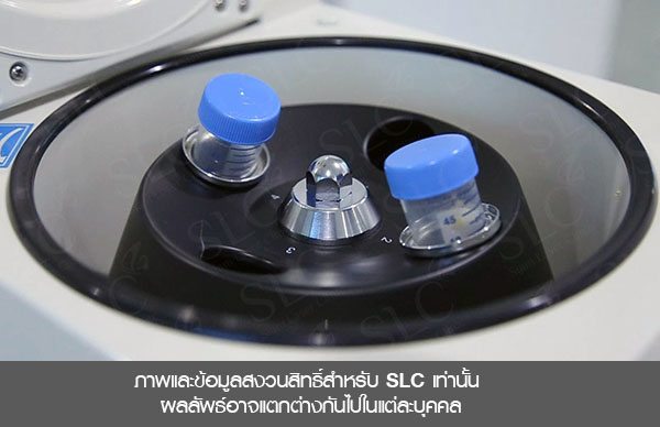 เติมไขมัน SLC