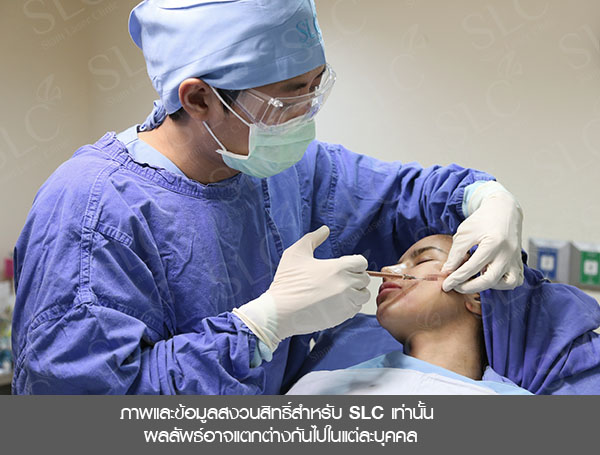 ฉีดไขมันหน้า SLC