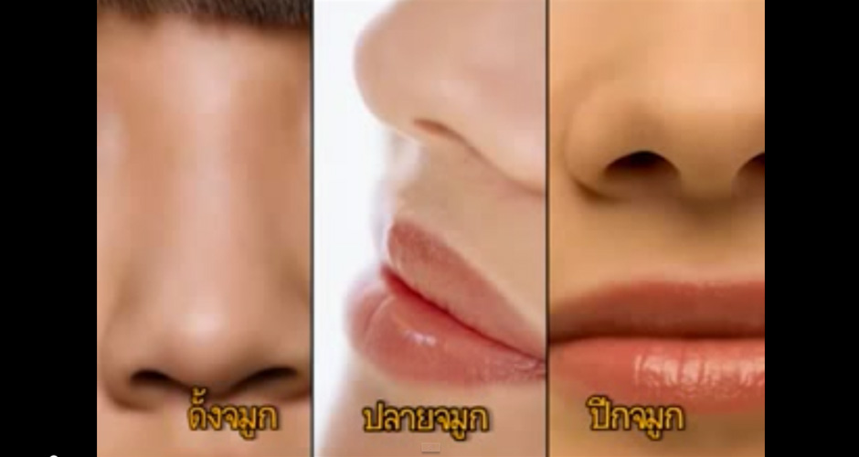 เทป2 Makeove S1 ศัลยกรรมจมูกซิลิโคน Rhinoplasty