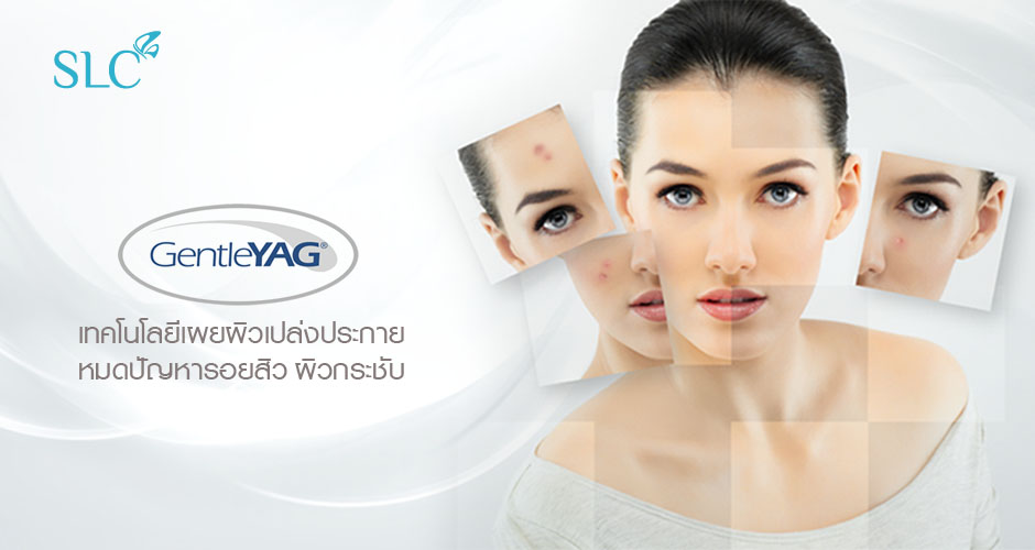 Gentle YAG Laser