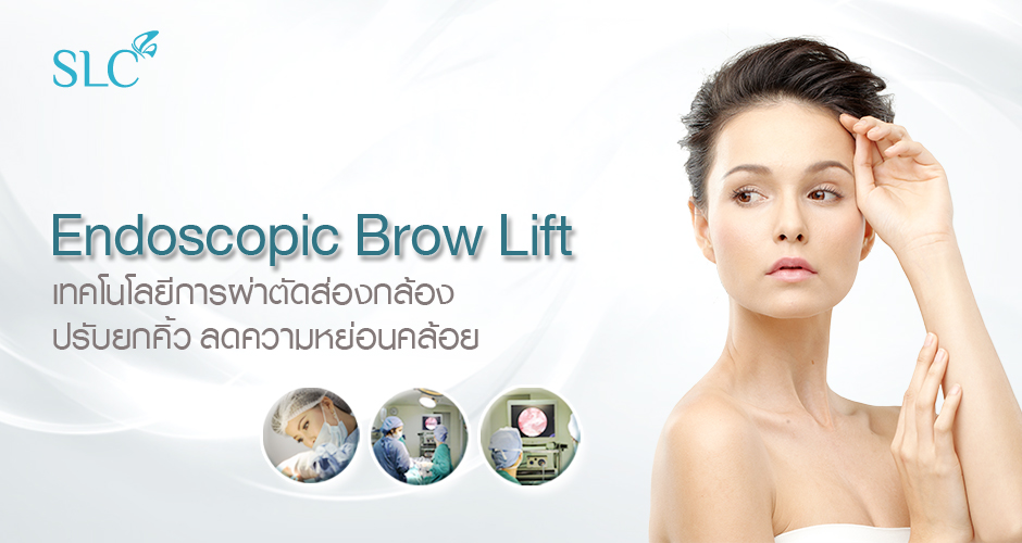 Endoscopic Brow Lift ยกคิ้ว ยกหน้าผาก แก้ไขหนังตาตก