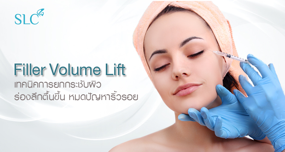 Filler Volume Lift