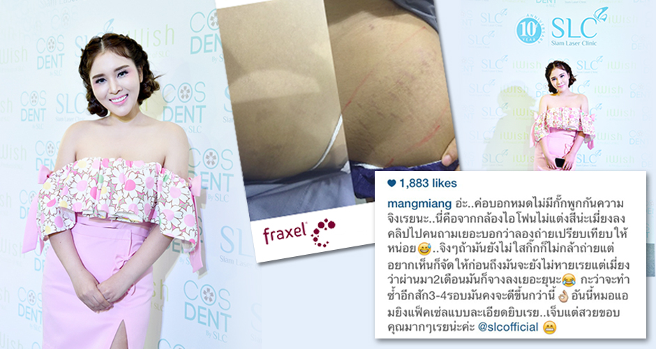 Khun Maleangmiang-a million event girl who resumed her perfect shape after giving birth to a baby girl called Mina.