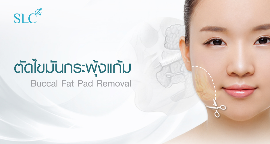 Buccal Fat Pad Removal
