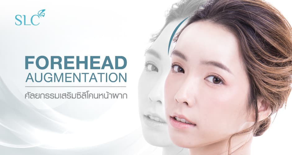 Forehead Augmentation