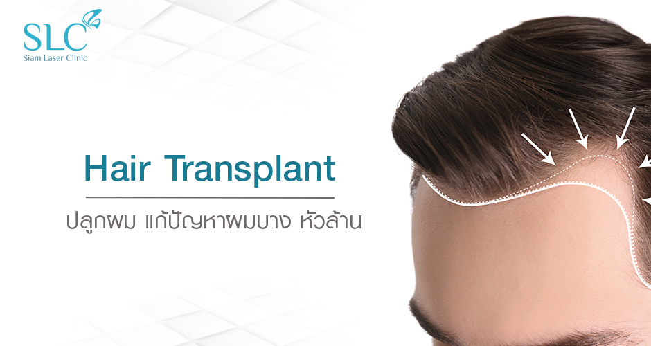 Hair Transplant