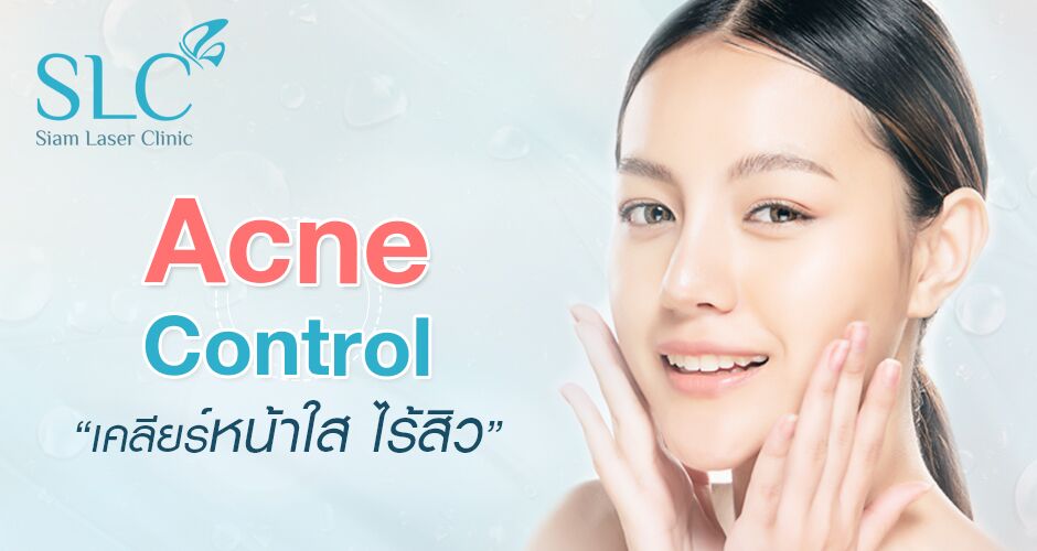 Acne Control เคลียร์ หน้าใส ไร้สิว