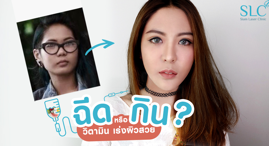 ฉีดหรือกิน?  วิตามิน เร่งผิวสวย