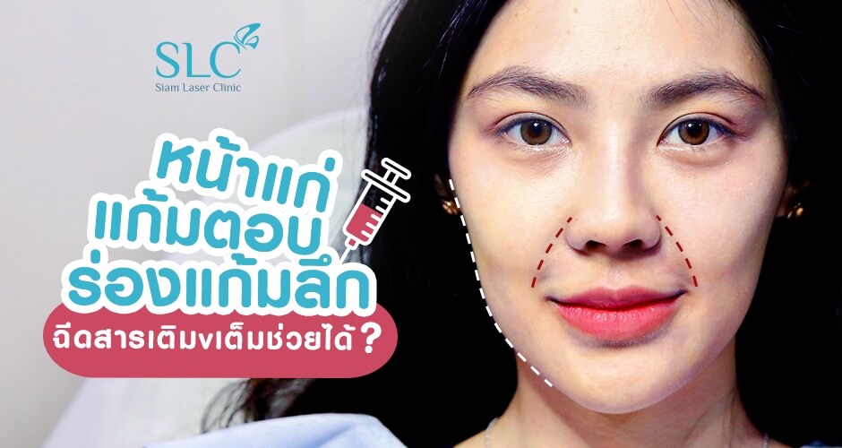 หน้าแก่ แก้มตอบ ร่องแก้มลึก ฉีดสารเติมเต็มช่วยได้?