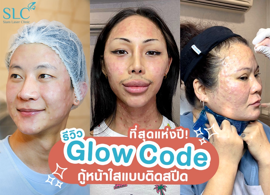 ที่สุดแห่งปี! รีวิว Glow Code กู้หน้าใสแบบติดสปีด