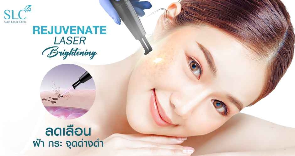 Rejuvenate Laser Brightening เลเซอร์หน้าใส ลดเลือนฝ้า กระ จุดด่างดำ