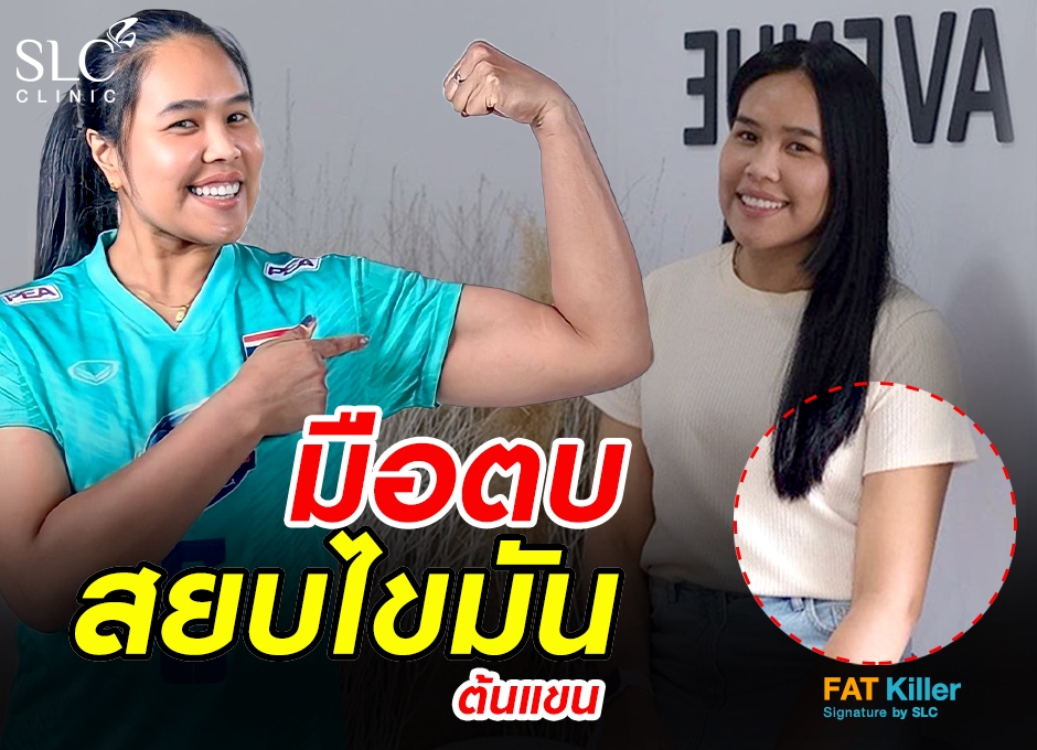 มือตบ สยบไขมัน ลดต้นแขน Fat Killer