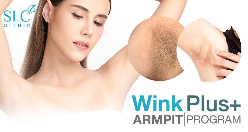 Wink Plus Armpit โปรแกรมรักแร้ขาว