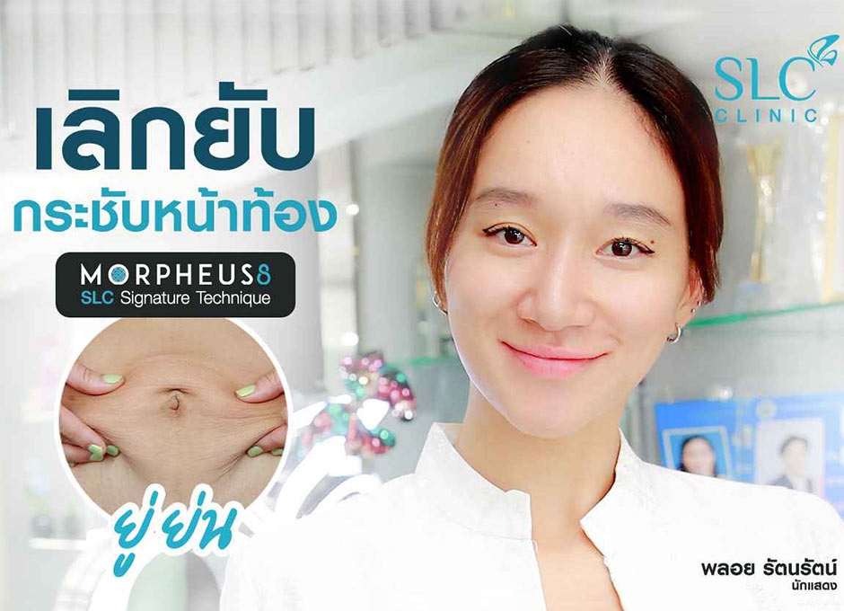 แม่ลูก 3 แก้ผิวหนังย่นด้วย Morpheus 8 SLC Signature Technique Body