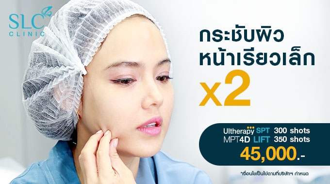 กระชับผิว หน้าเรียวเล็ก x2 Ultherapy SPT 300 Shot +  MPT 4D Lift 350 shots ราคา 45,000-.