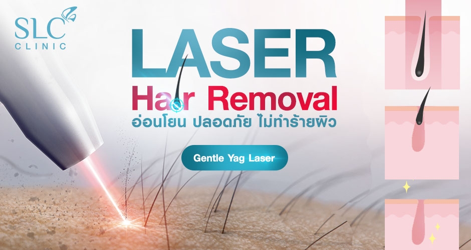 กำจัดขนที่ไหนดี มา SLC Clinic เลย Laser Hair Removal ด้วย Gentle Yag Laser กำจัดขน SLC Clinic เนียนนานไม่มีตอ