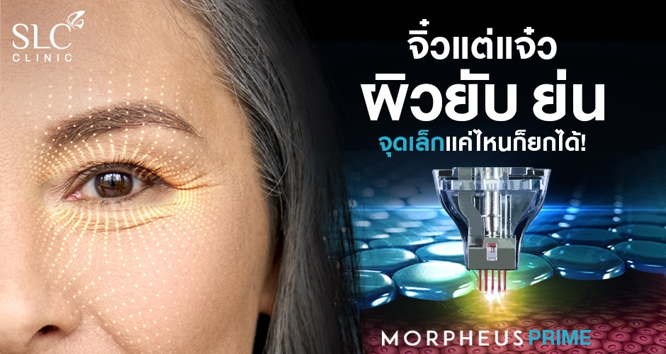 Morpheus Prime จิ๋วแต่แจ๋ว ผิวยับ ย่น จุดเล็กแค่ไหนก็ยกได้!