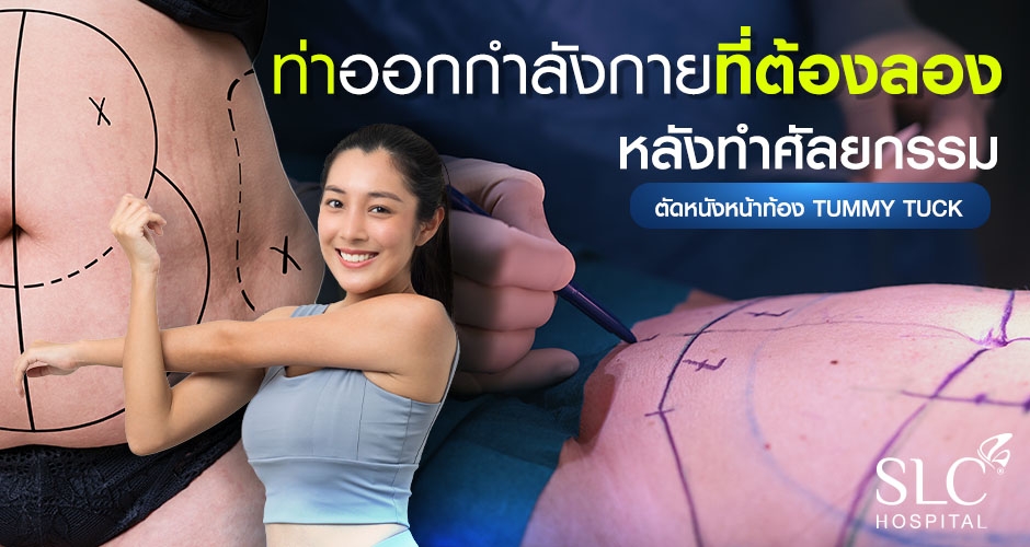 ท่าออกกำลังกายที่ต้องลองหลังทำศัลยกรรม ตัดหนังหน้าท้อง Tummy Tuck