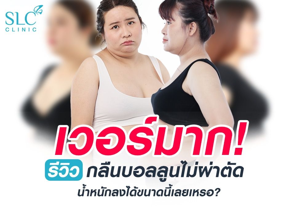 เวอร์มาก! รีวิวกลืนบอลลูนไม่ผ่าตัด น้ำหนักลงได้ขนาดนี้เลยเหรอ?