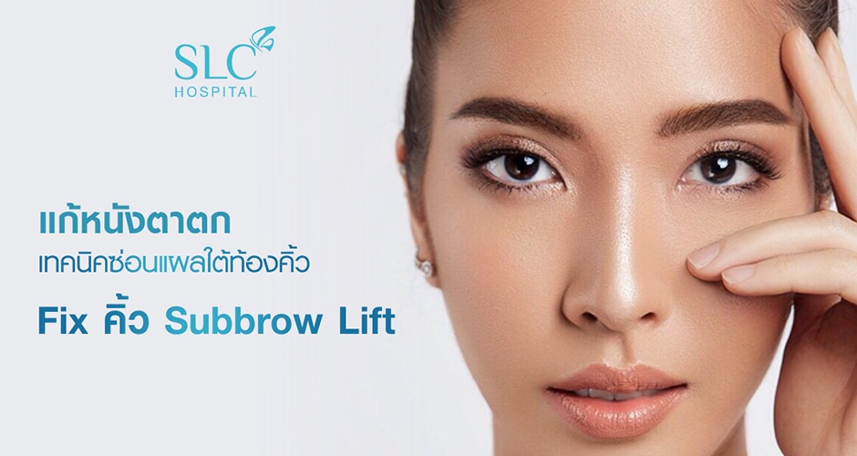 หนังตาตก หนังตาเยอะ แก้ได้! ศัลยกรรม Fix คิ้ว Subbrow Age-Delay Lift ™