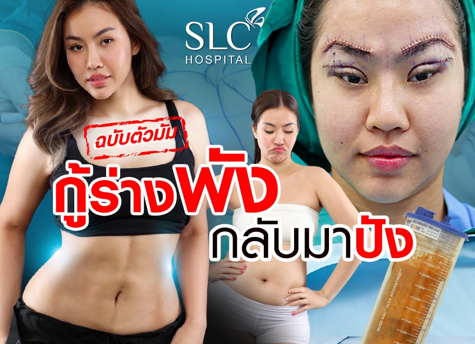 ตำนานสาวแบล็คสวอน ดูดไขมัน กู้ร่างพังให้กลับมาปังฉบับตัวแม่