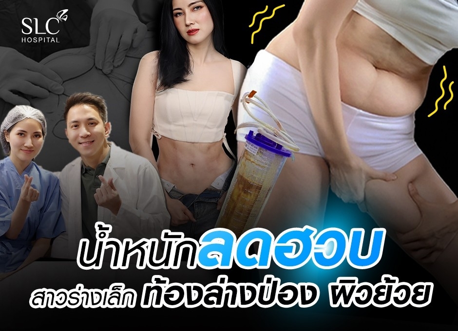 สาวร่างเล็ก ดูดไขมันหมอโบ๊ท หลังน้ำหนักลดฮวบ จนเกิดปัญหา หน้าท้องล่างป่อง ผิวย้วย