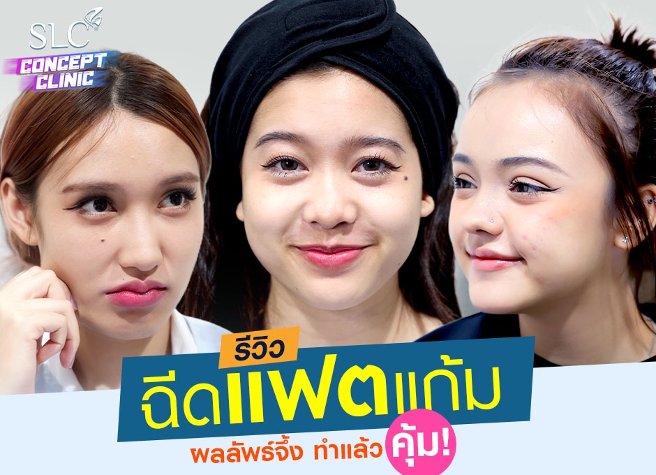 รีวิวฉีดแฟตแก้ม ผลลัพธ์จึ้ง ทำแล้วคุ้ม!