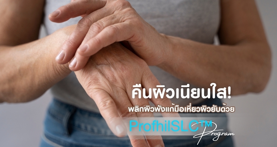 พลิกผิวพังแก้มือเหี่ยวผิวยับด้วย ProfhilSLC™Program คืนผิวเนียนใส