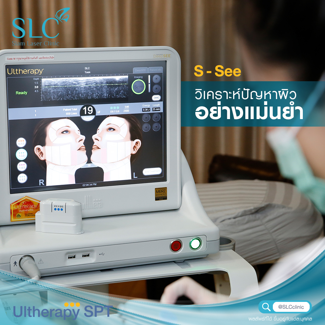 Ultherapy SPT ยกกระชับ