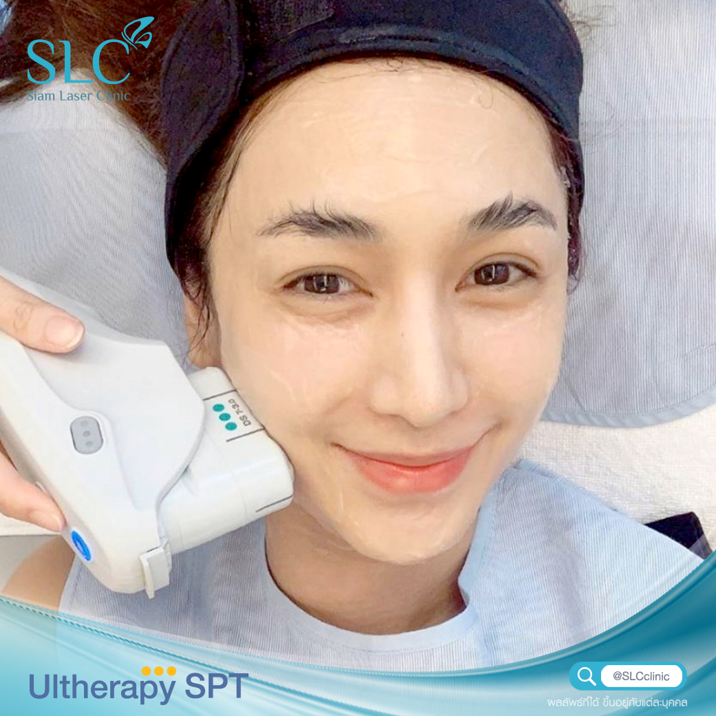 Ultherapy SPT ยกกระชับ