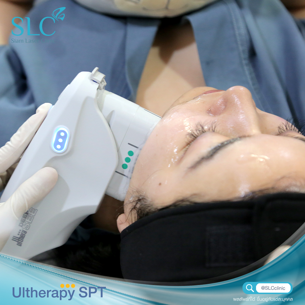 Ultherapy SPT ยกกระชับ