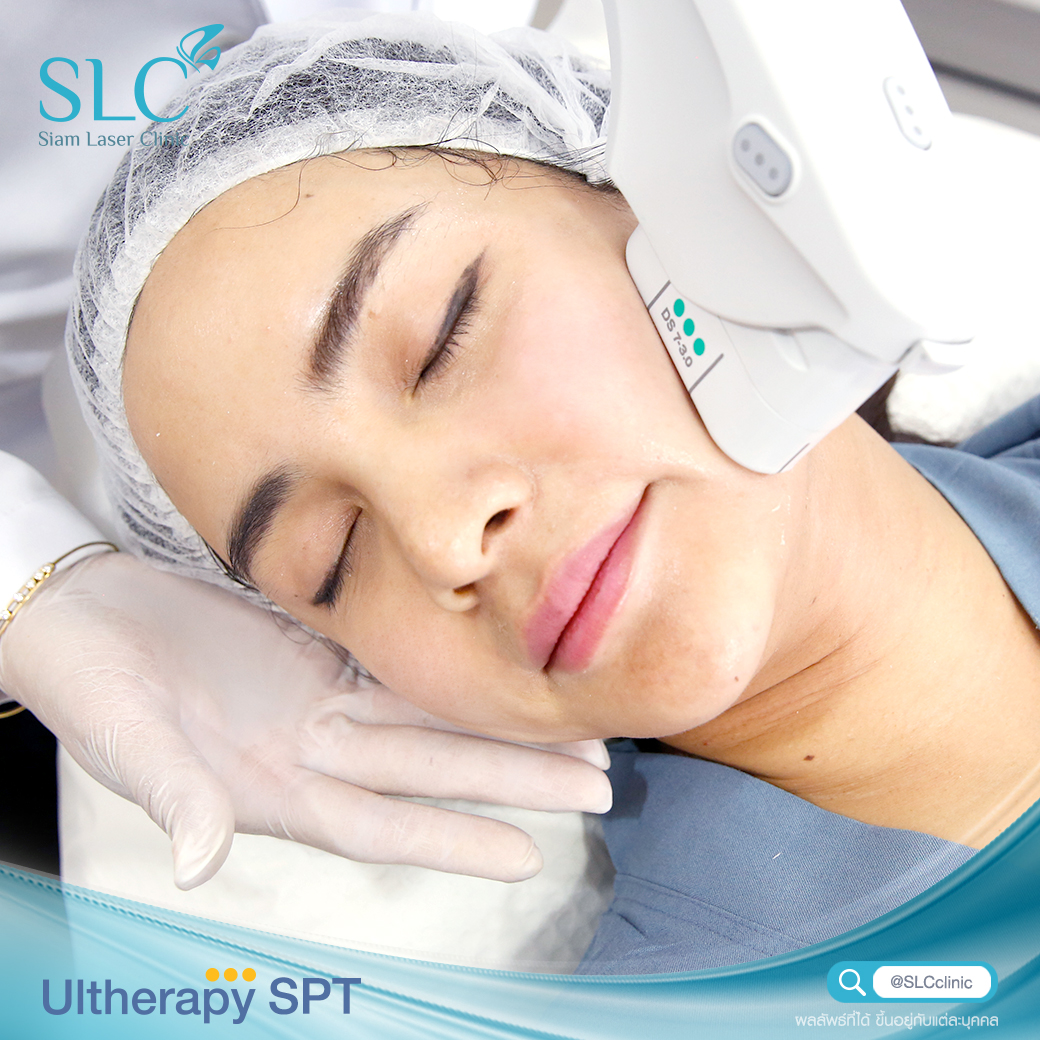 Ultherapy SPT ยกกระชับ