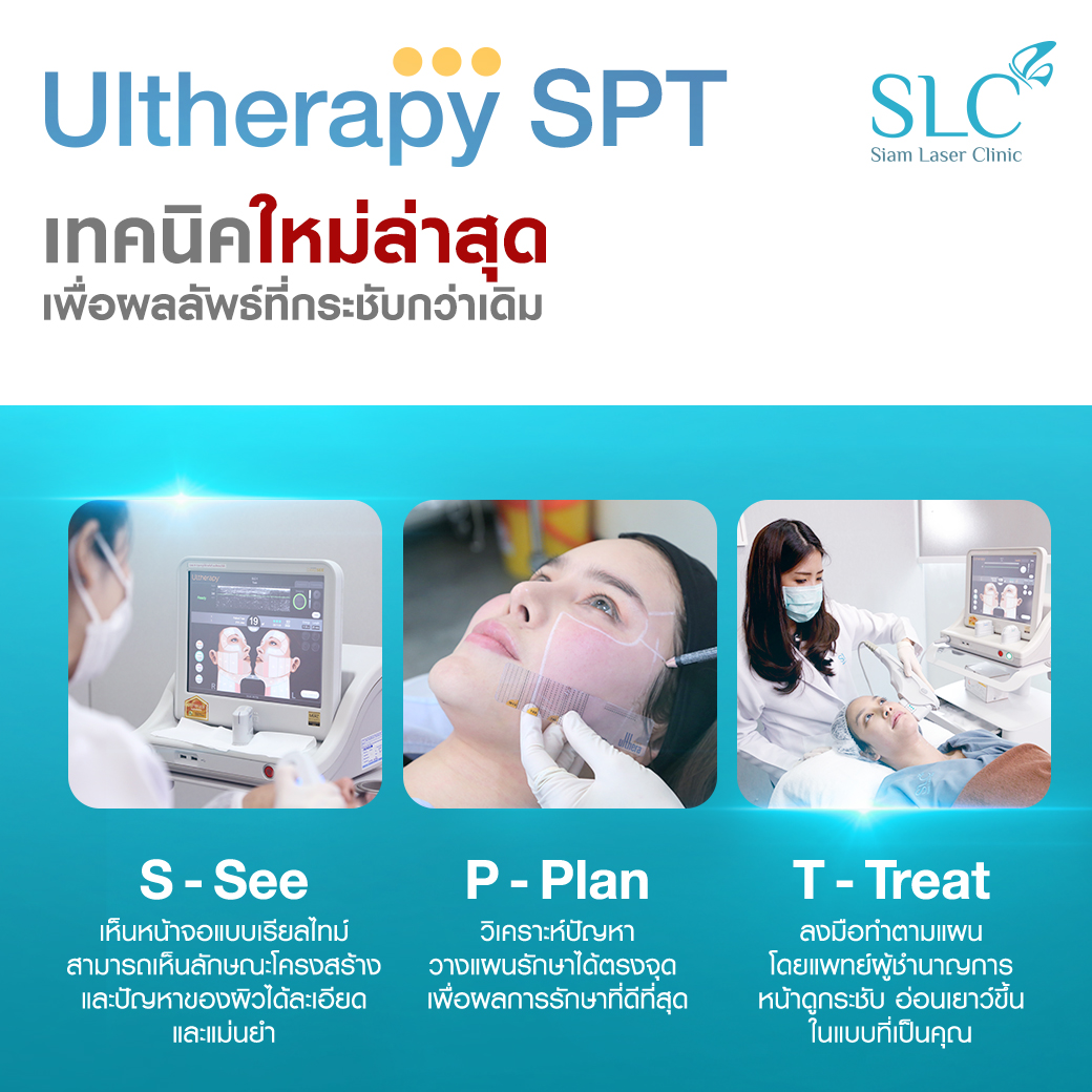 Ultherapy SPT ยกกระชับ