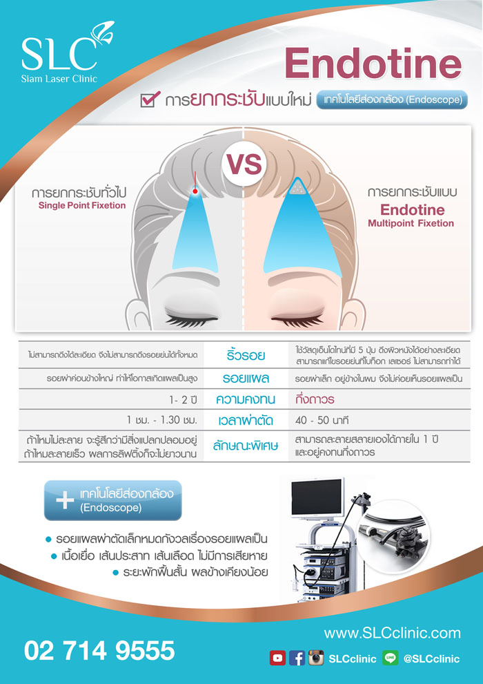 ยกคิ้ว ยกหน้าผาก แก้ไขหน้งตาตก Endotine