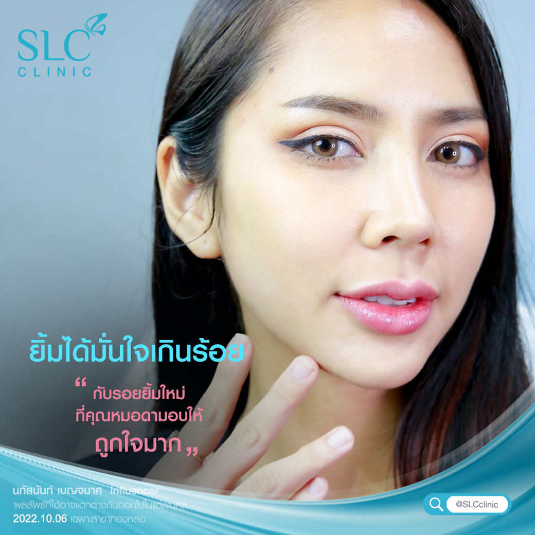 รีวิวฉีดปาก ฟิลเลอร์ปากSLC หมอดาSLC