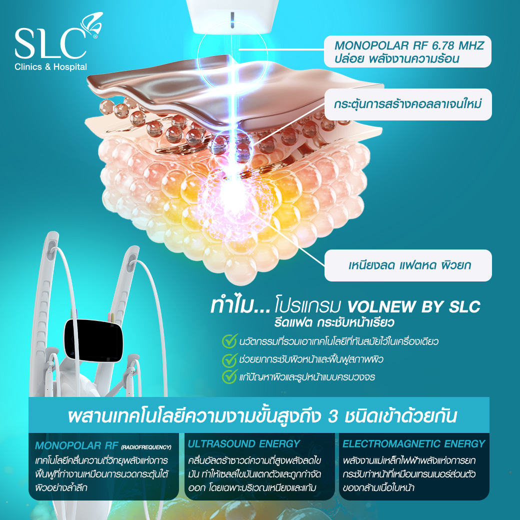 ลดเหนียง, เครื่องยกกระชับ Volnew, ลดไขมัน, หน้ายกแฟตหด, ลดแก้ม