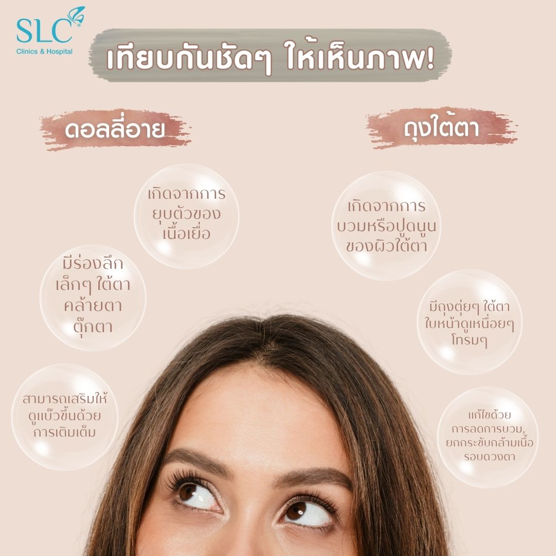 ดอลลี่อาย, ถุงใต้ตา