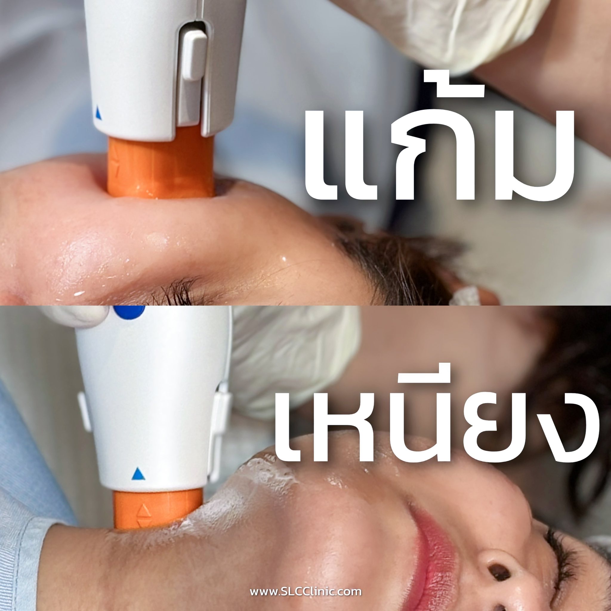 Oligio , Billkin & PP Krit , บิวกิ้น , พีพี