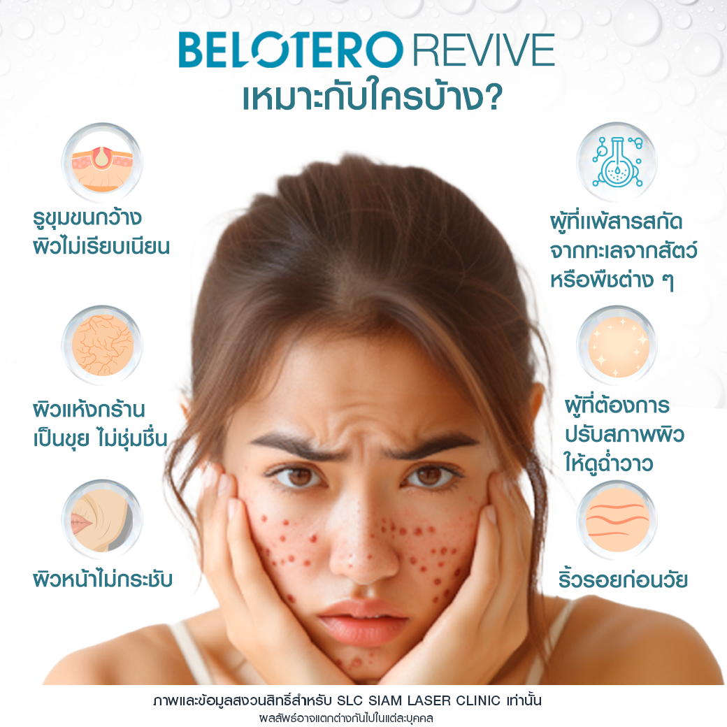 ฟิลเลอร์งานผิว, Belotero Revive, Belotero, ผิวฉ่่ำน้ำ, Filler