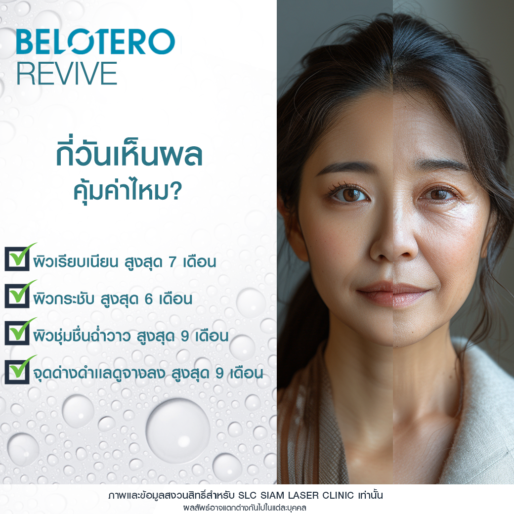 ฟิลเลอร์งานผิว, Belotero Revive, Belotero, ผิวฉ่่ำน้ำ, Filler