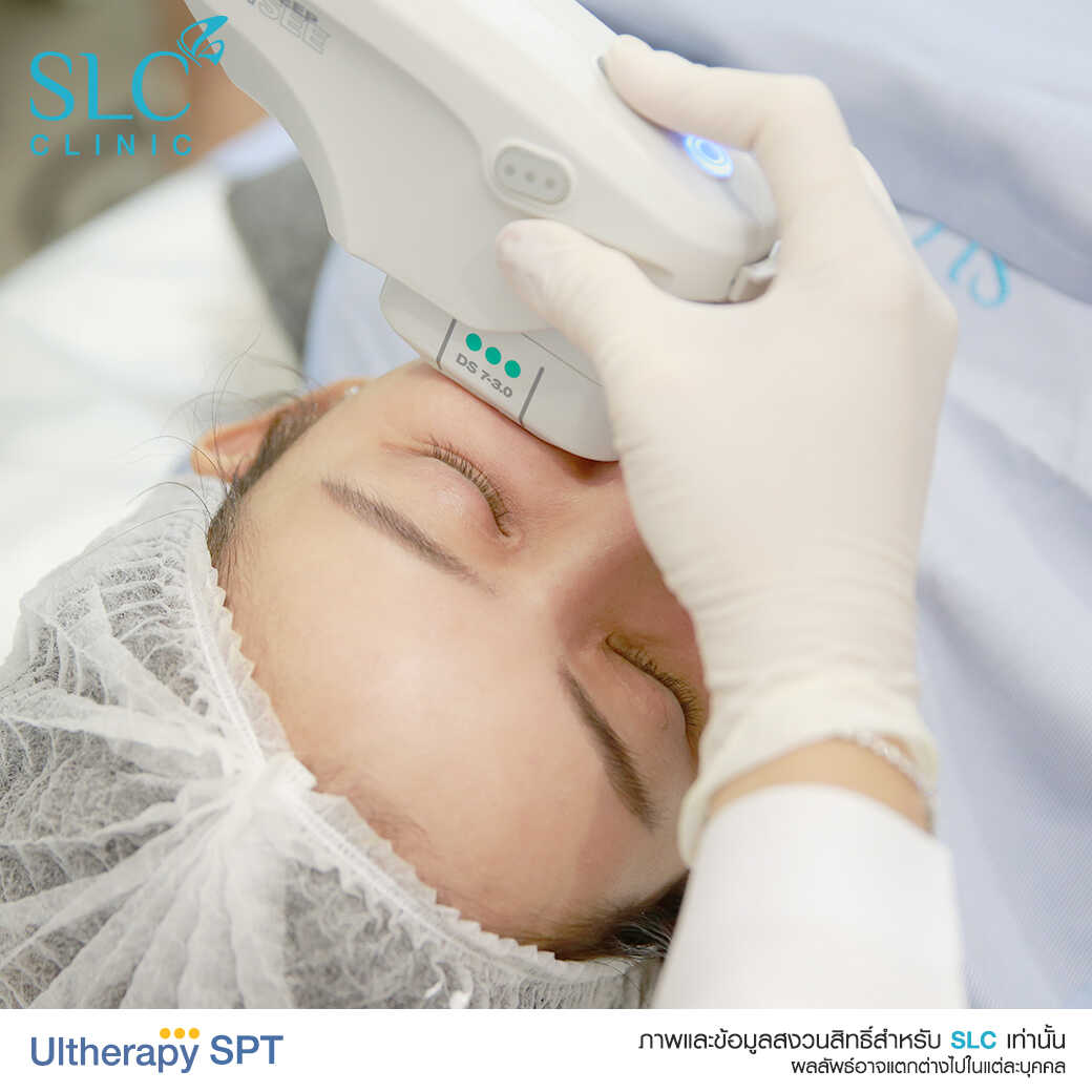 Ultherapy แก้หนังตาตก ยกคิ้ว