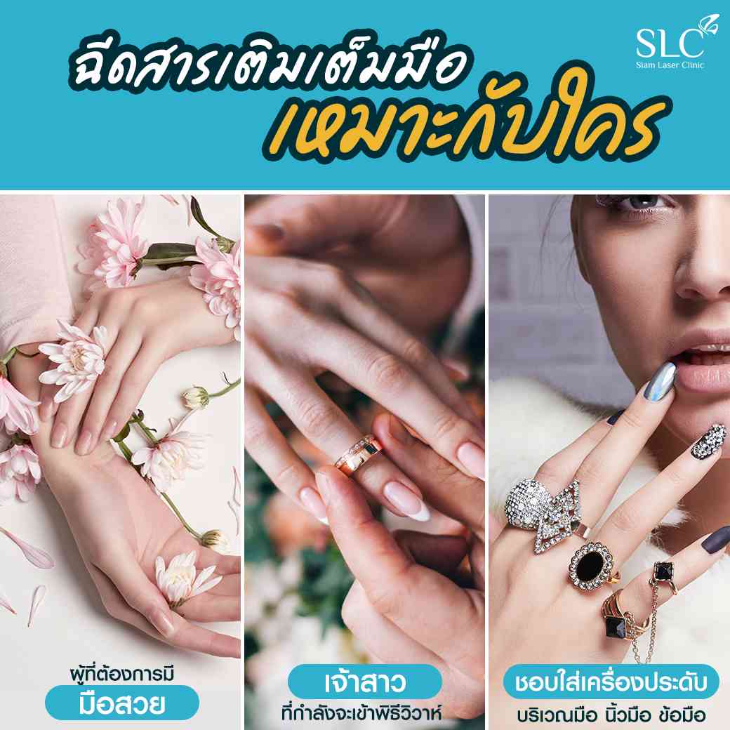 ฉีดสารเติมเต็มมือเหมาะกับใคร-ฟิลเลอร์มือแก้มือเหี่ยว-ฟิลเลอร์มือ