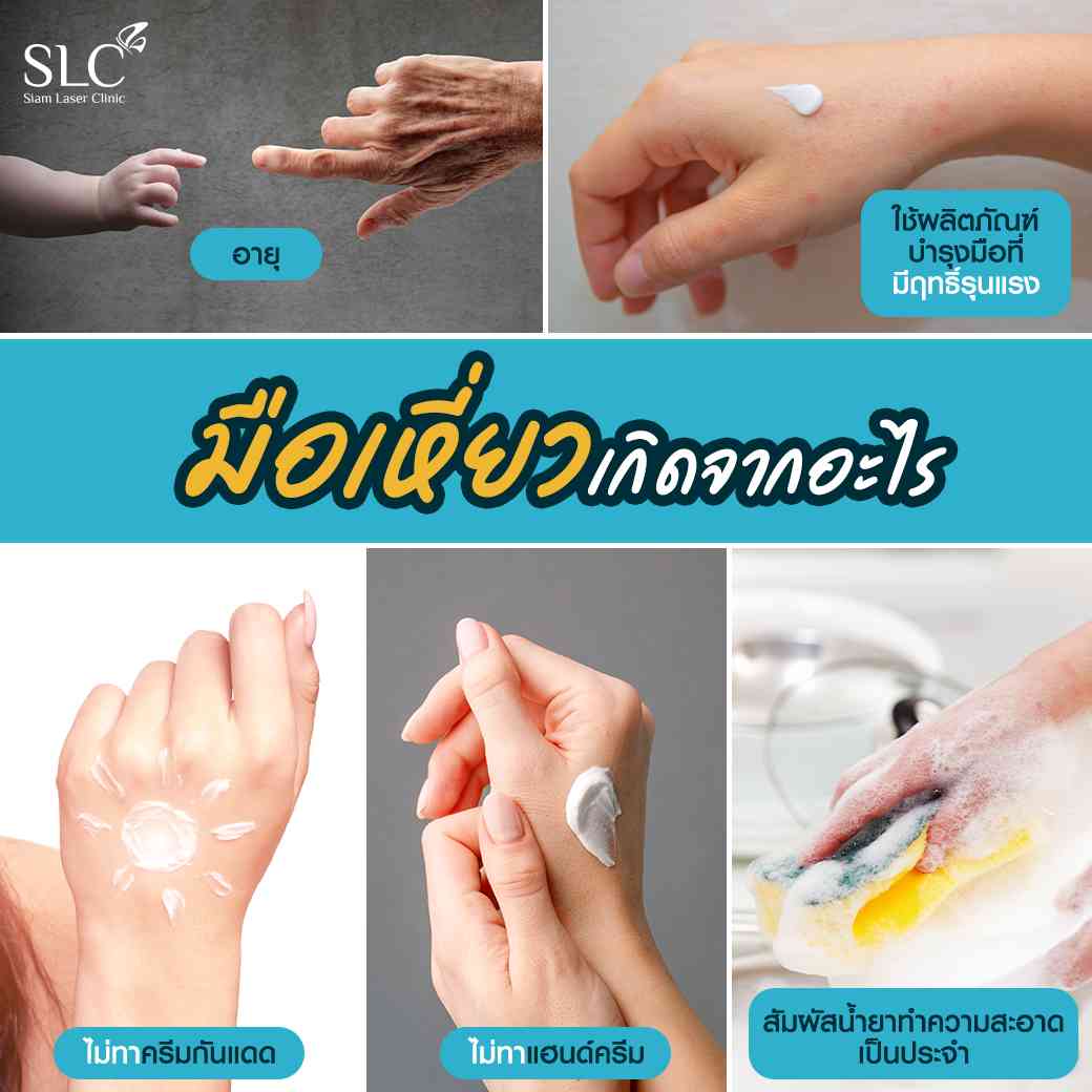 มือเหี่ยวเกิดจากอะไร-ฟิลเลอร์มือแก้มือเหี่ยว-ฟิลเลอร์มือ