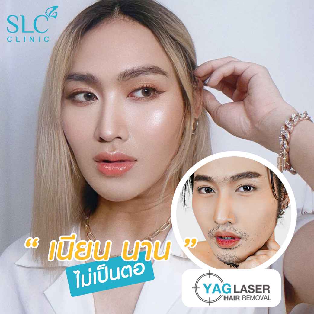  มูสกำจัดขน, เลเซอร์ขน, slc เลเซอร์ขน, เลเซอร์ขน yag, เลเซอร์ขน slc, slc clinic เลเซอร์ขน, กำจัดขน, gentle yag laser