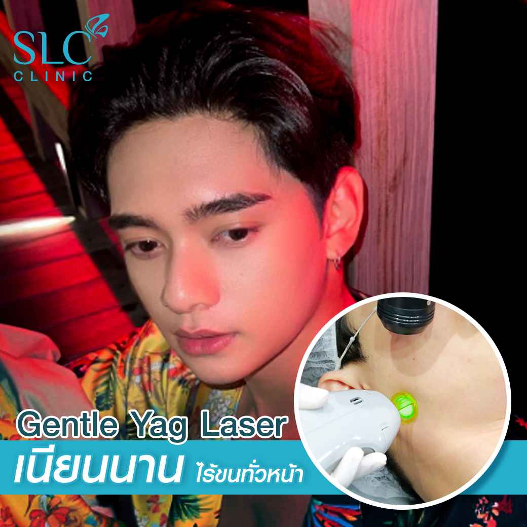  มูสกำจัดขน, เลเซอร์ขน, slc เลเซอร์ขน, เลเซอร์ขน yag, เลเซอร์ขน slc, slc clinic เลเซอร์ขน, กำจัดขน, gentle yag laser