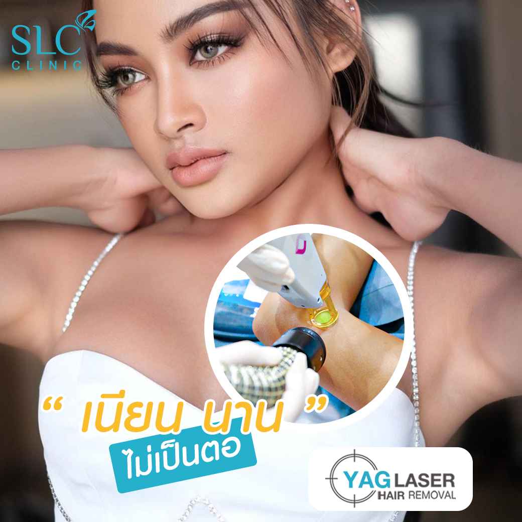  มูสกำจัดขน, เลเซอร์ขน, slc เลเซอร์ขน, เลเซอร์ขน yag, เลเซอร์ขน slc, slc clinic เลเซอร์ขน, กำจัดขน, gentle yag laser